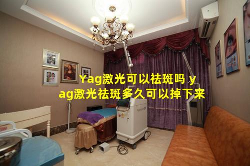 Yag激光可以祛斑吗 yag激光祛斑多久可以掉下来